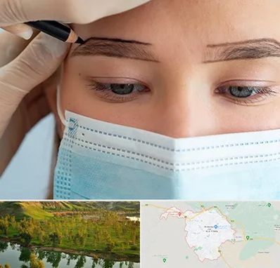 کاشت ابرو در بهبهان