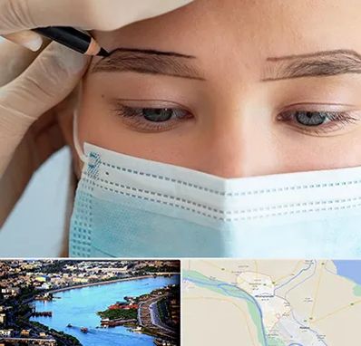 کاشت ابرو در خرمشهر