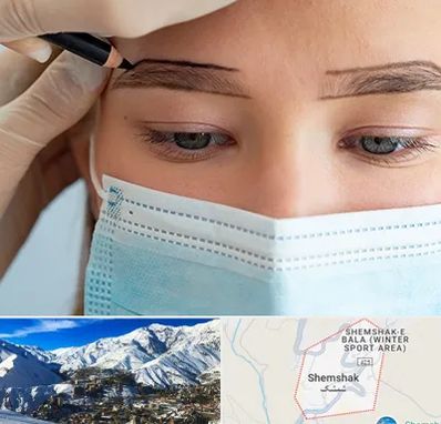 کاشت ابرو در شمشک
