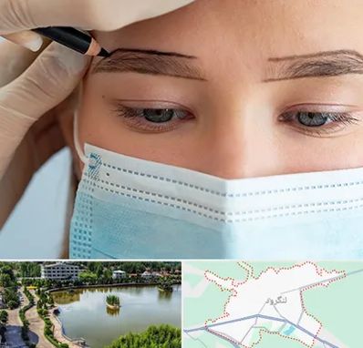 کاشت ابرو در لنگرود