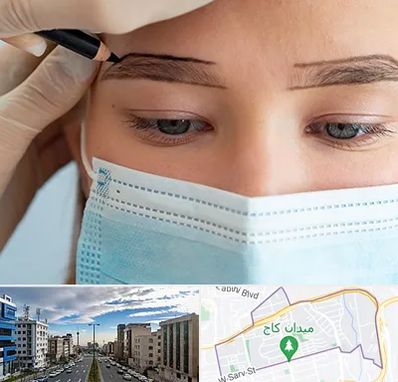 کاشت ابرو در سعادت آباد 