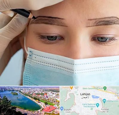 کاشت ابرو در لاهیجان