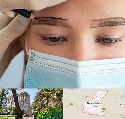 کاشت ابرو در نیشابور