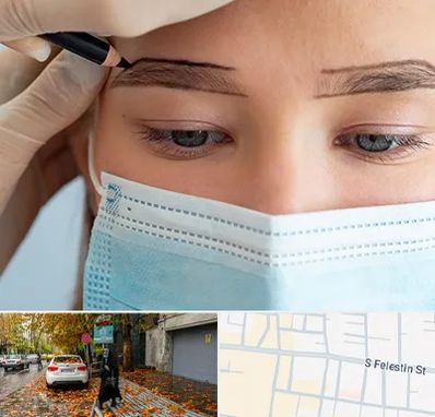 کاشت ابرو در خیابان فلسطین