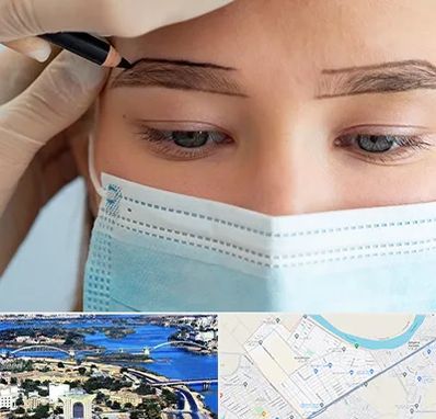 کاشت ابرو در کوروش اهواز 