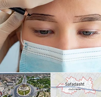 کاشت ابرو در صفادشت