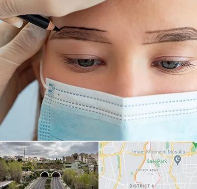 کاشت ابرو در یوسف آباد 