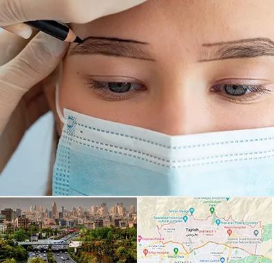 کاشت ابرو در منطقه 1 تهران 