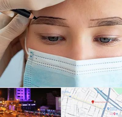 کاشت ابرو در آبرسان تبریز