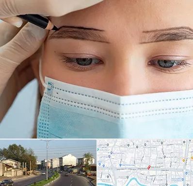 کاشت ابرو در ضیابری رشت 