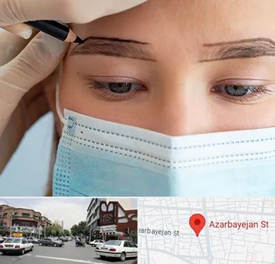 کاشت ابرو در خیابان آذربایجان