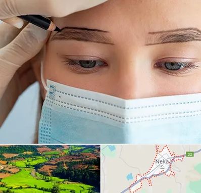 کاشت ابرو در نکا