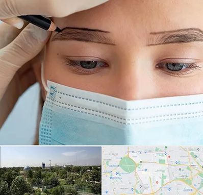 کاشت ابرو در منطقه 16 تهران 