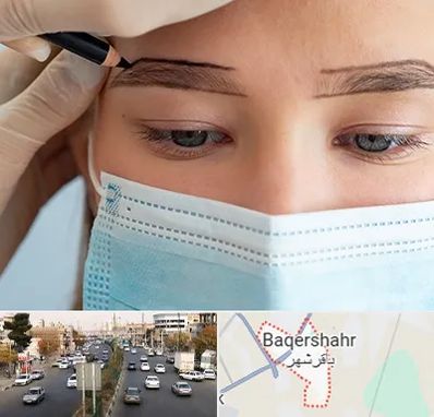 کاشت ابرو در باقرشهر