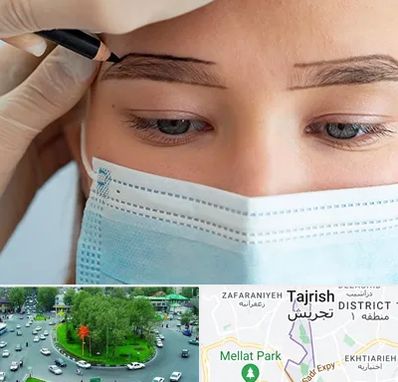 کاشت ابرو در تجریش 