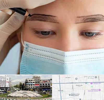 کاشت ابرو در مرکز تهران