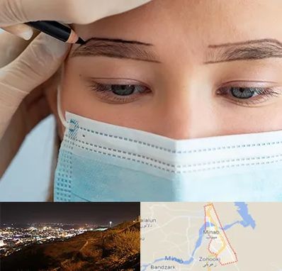 کاشت ابرو در میناب