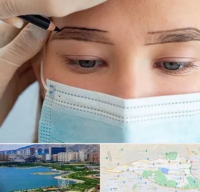 کاشت ابرو در منطقه 22 تهران 