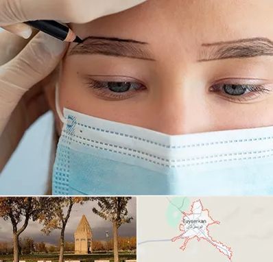 کاشت ابرو در تویسرکان