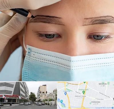 کاشت ابرو در بلوار فردوس 
