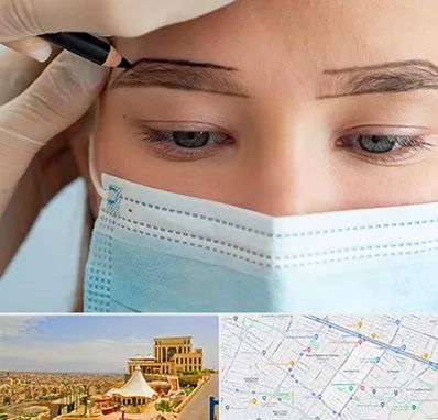 کاشت ابرو در هاشمیه مشهد 