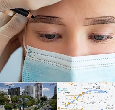 کاشت ابرو در اندرزگو 