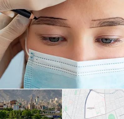 کاشت ابرو در جمشیدیه