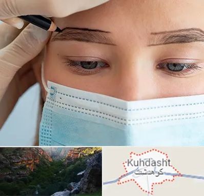 کاشت ابرو در کوهدشت