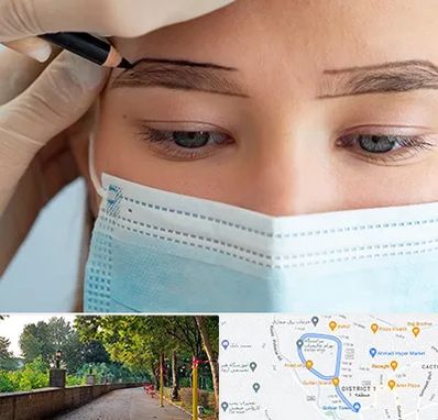 کاشت ابرو در بلوار گیلان رشت 