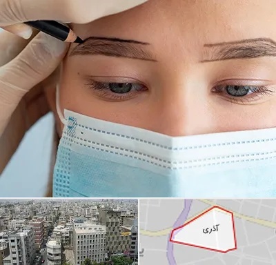 کاشت ابرو در آذری
