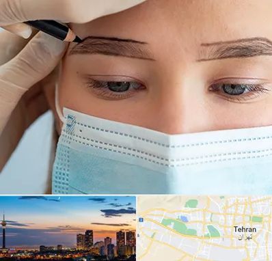 کاشت ابرو در غرب تهران 