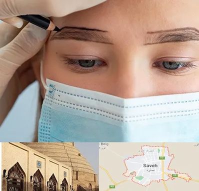 کاشت ابرو در ساوه