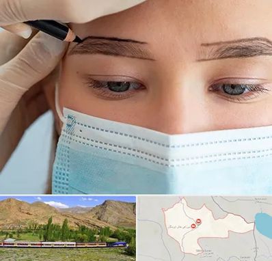 کاشت ابرو در خاش