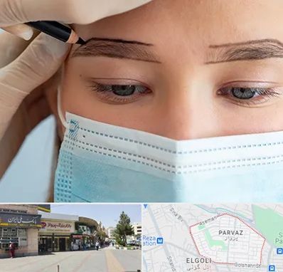 کاشت ابرو در پرواز تبریز