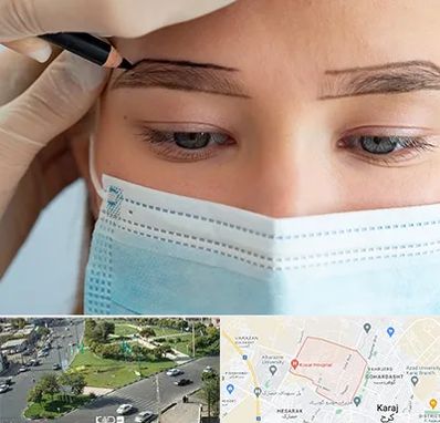 کاشت ابرو در شاهین ویلا کرج 