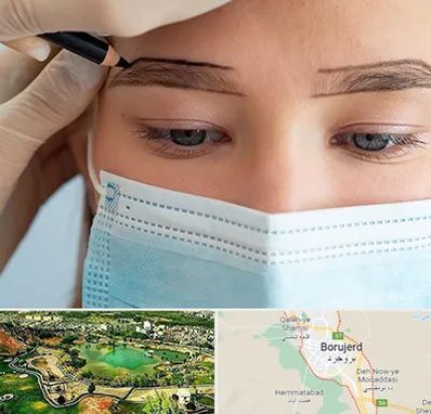کاشت ابرو در بروجرد
