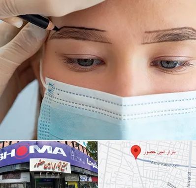 کاشت ابرو در امین حضور