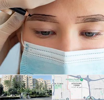 کاشت ابرو در آپادانا
