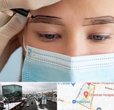کاشت ابرو در اقدسیه 