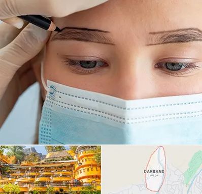 کاشت ابرو در دربند