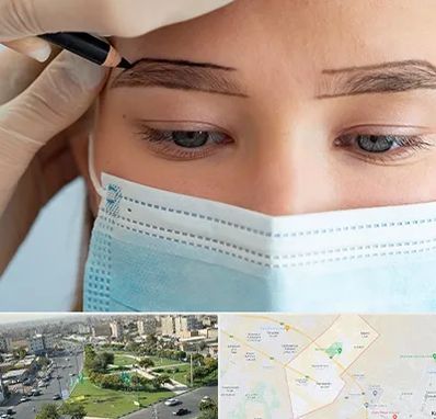 کاشت ابرو در کمال شهر کرج 