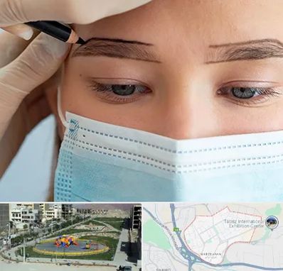 کاشت ابرو در مرزداران تبریز