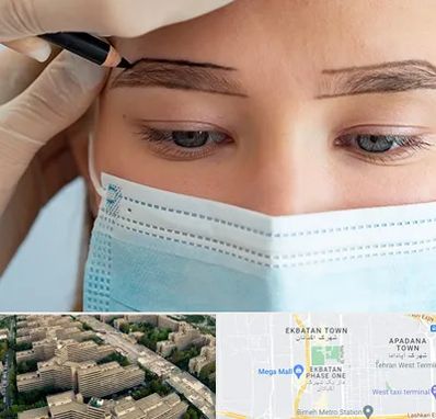 کاشت ابرو در اکباتان 