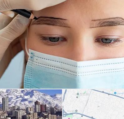 کاشت ابرو در ازگل