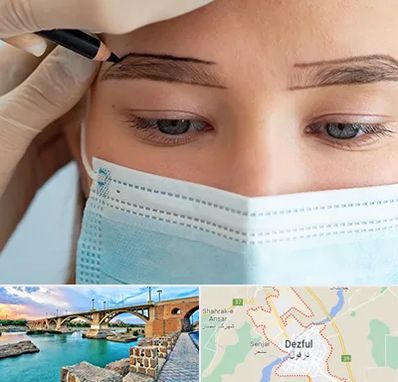 کاشت ابرو در دزفول