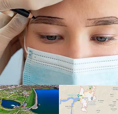 کاشت ابرو در مهاباد