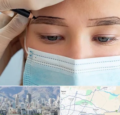 کاشت ابرو در شمال شرق تهران