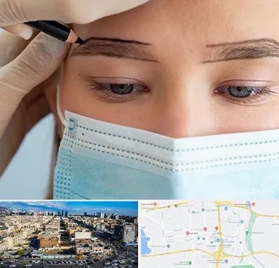 کاشت ابرو در شهرک راه آهن 