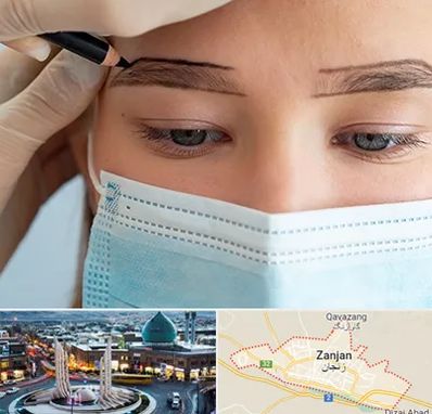 کاشت ابرو در زنجان