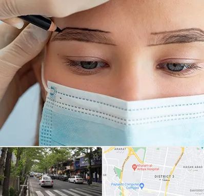 کاشت ابرو در ظفر 